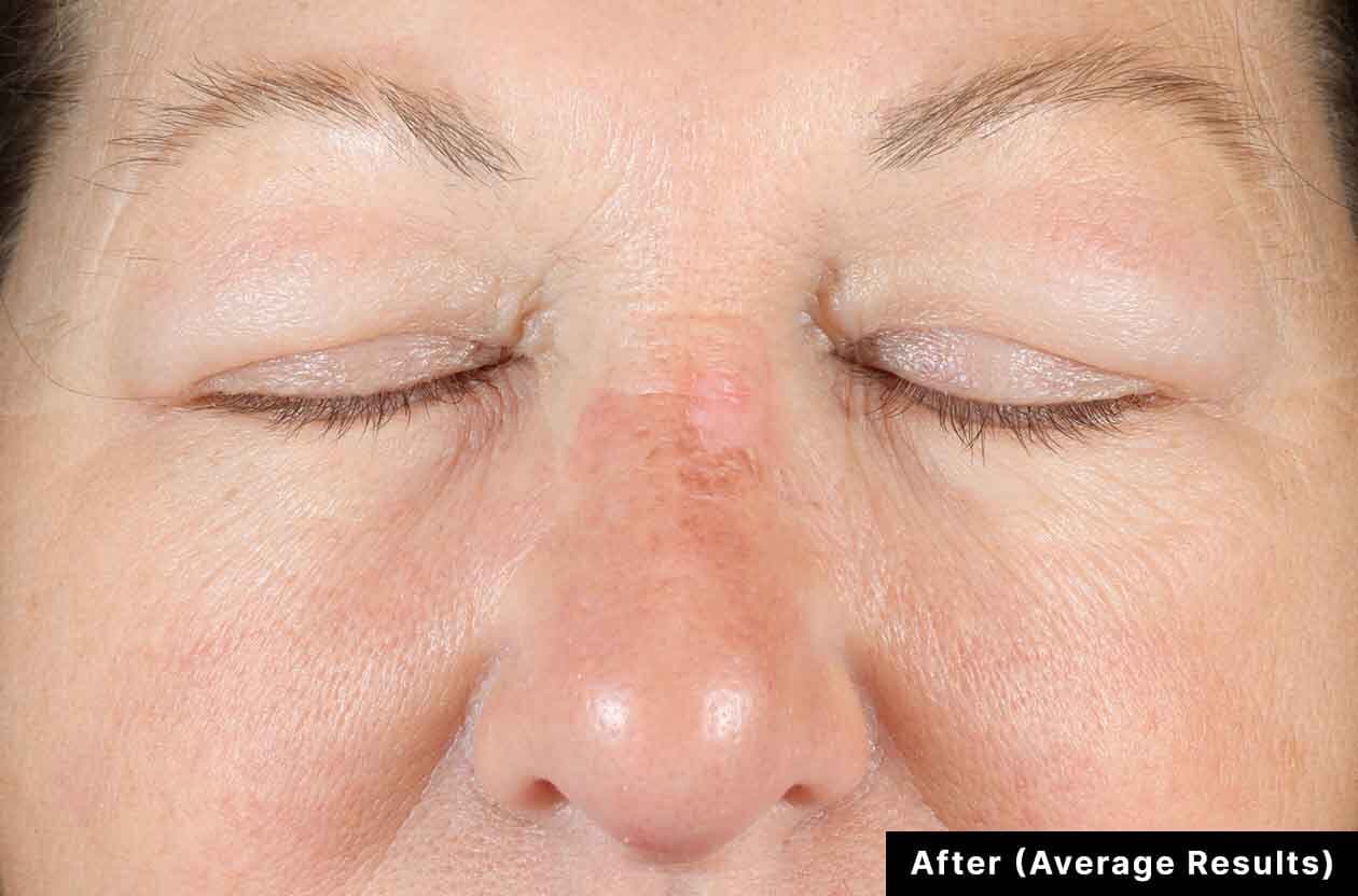 Before and after photos of a skincare protocol, Atelier Med selection.
